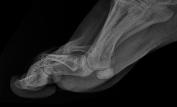 Foot xray